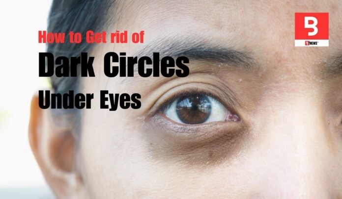 Get rid of dark circles under eyes, just follow these simple home remedies