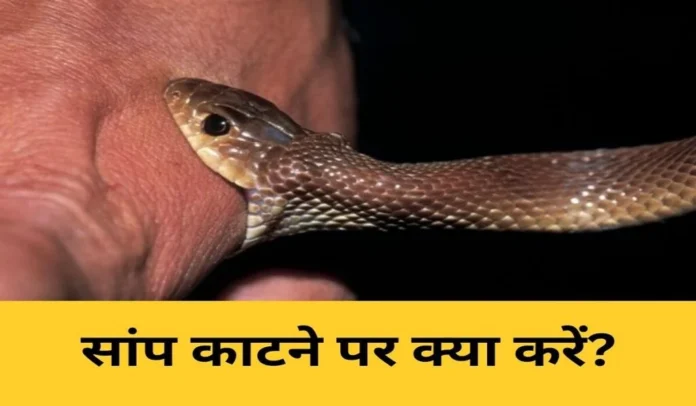 Snakebite