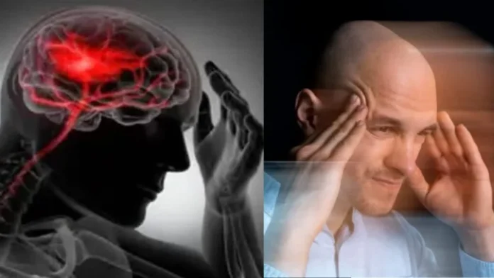 stroke